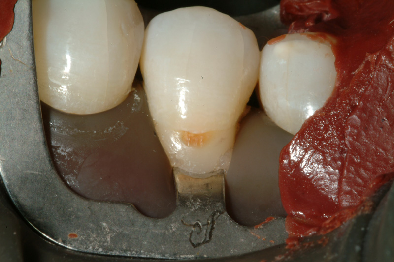 JSDSCF0071
