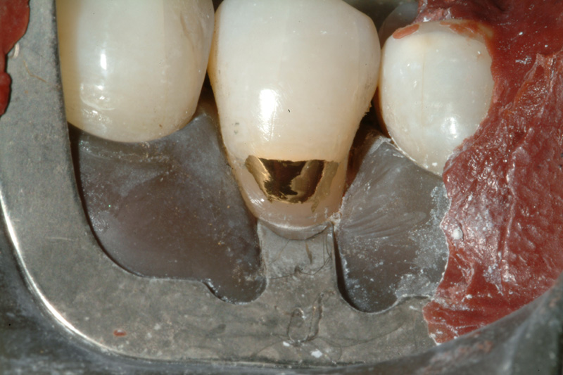 JSDSCF0107