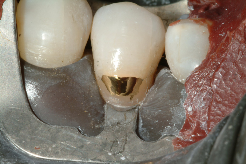 JSDSCF0108