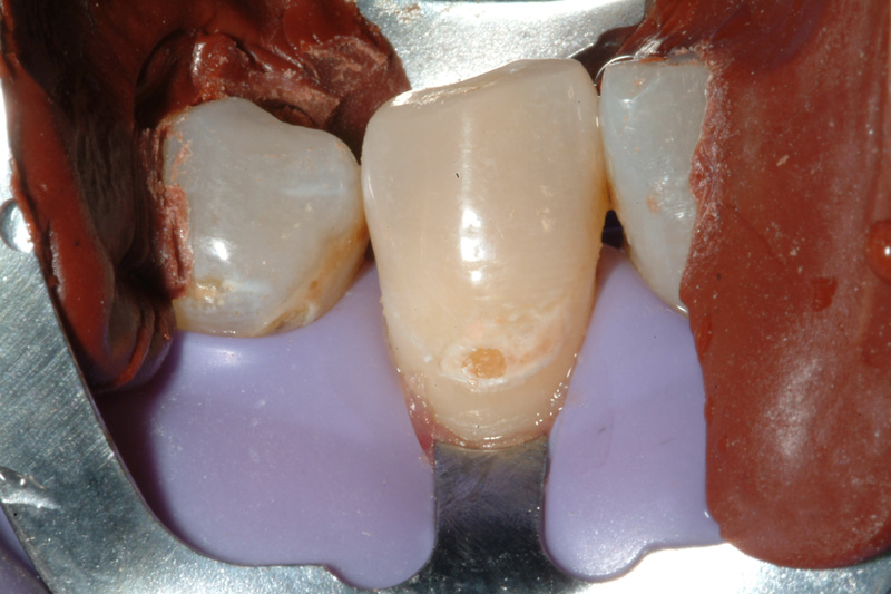 PMDSCF0070