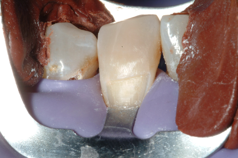 PMDSCF0080