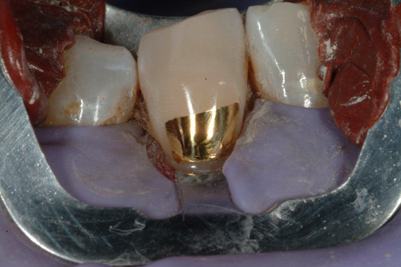 PMDSCF0100