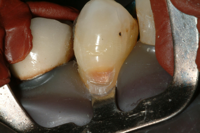 RADSCF0072