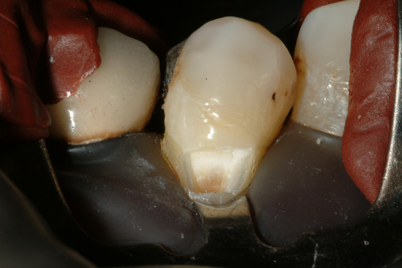RADSCF0084
