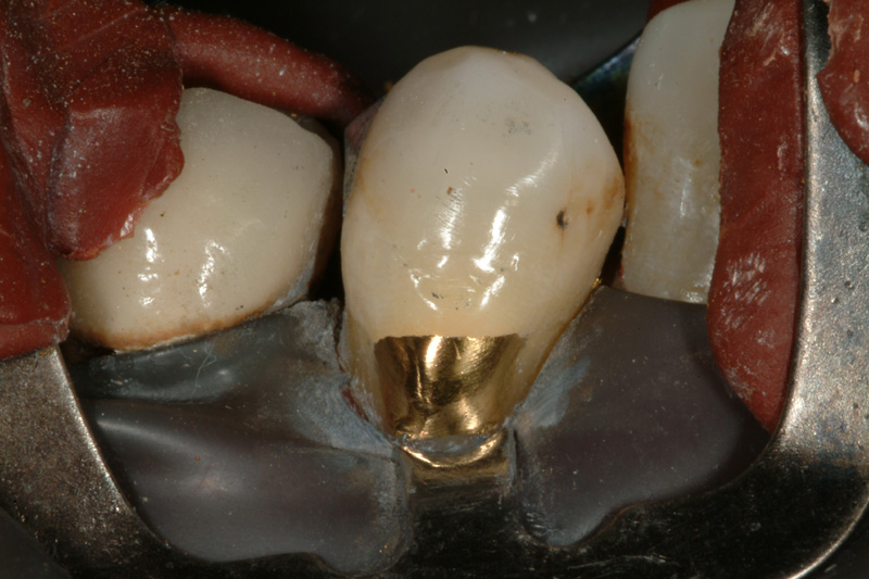 RADSCF0102