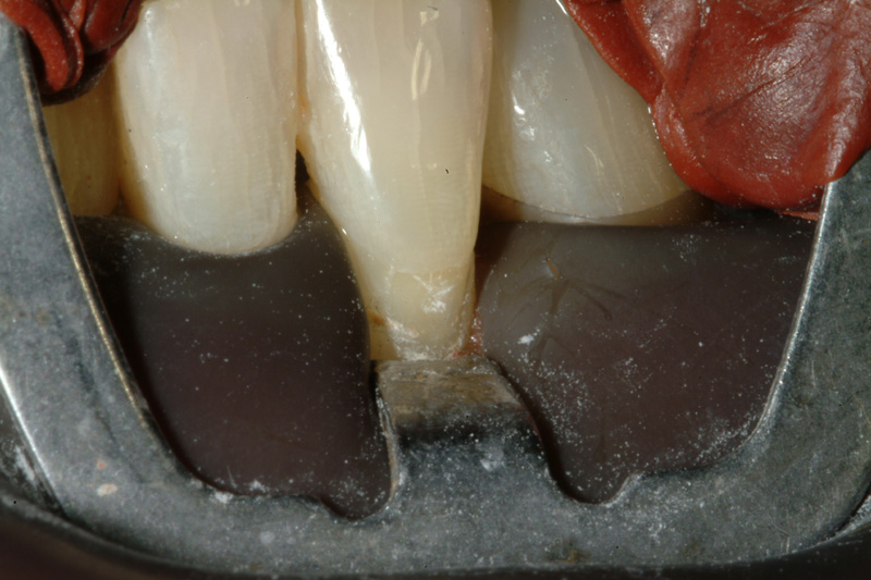 RHDSCF0068