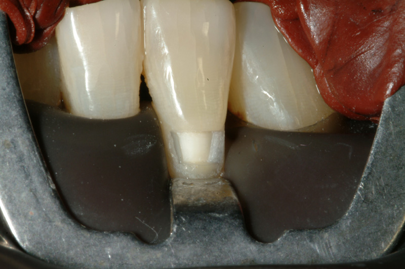 RHDSCF0076